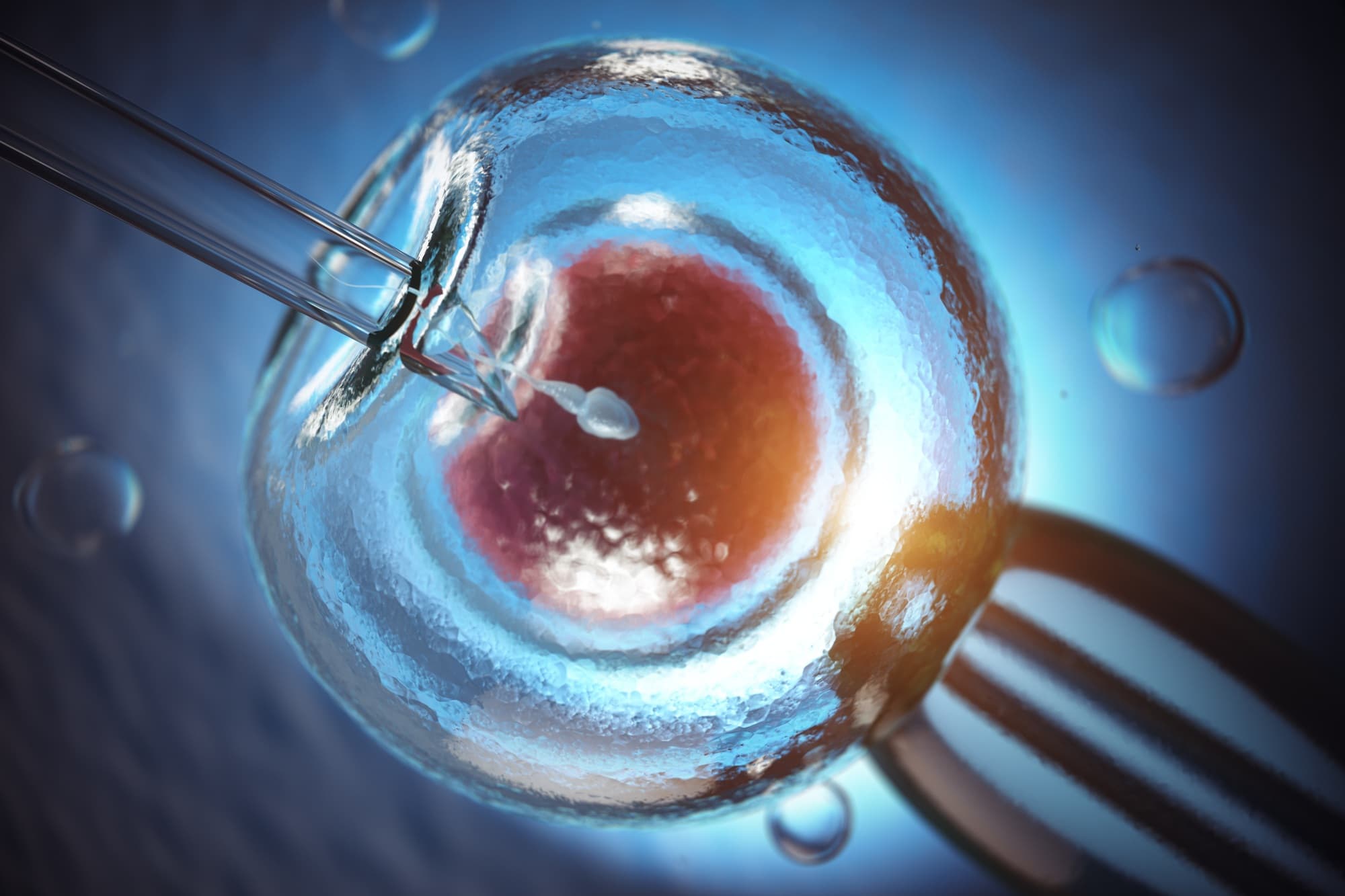 Fertilização in Vitro