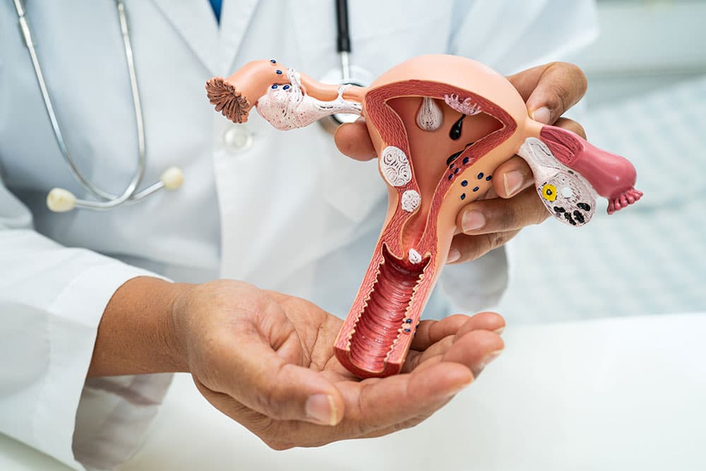 Inseminação Intrauterina